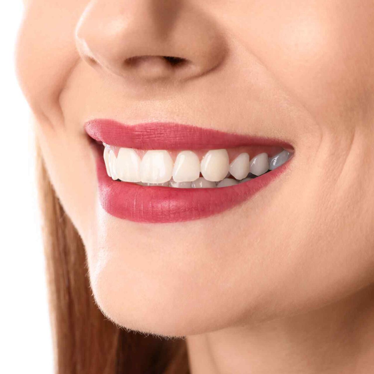 https://auroragroup.com.tr/wp-content/uploads/2020/03/service_whitening-1280x1280.jpg